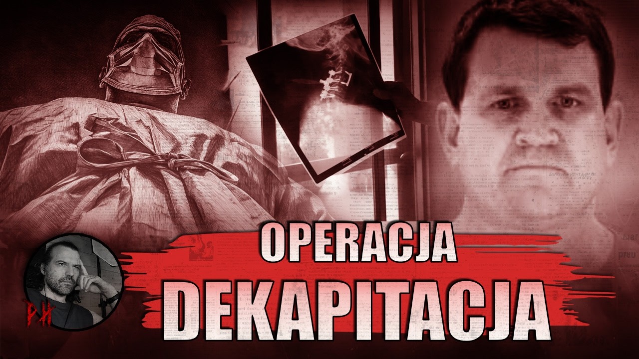 ZAMYKASZ OCZY na stole operacyjnym. BUDZISZ SIĘ w piekle - Przypadki Christophera DUNTSCHA