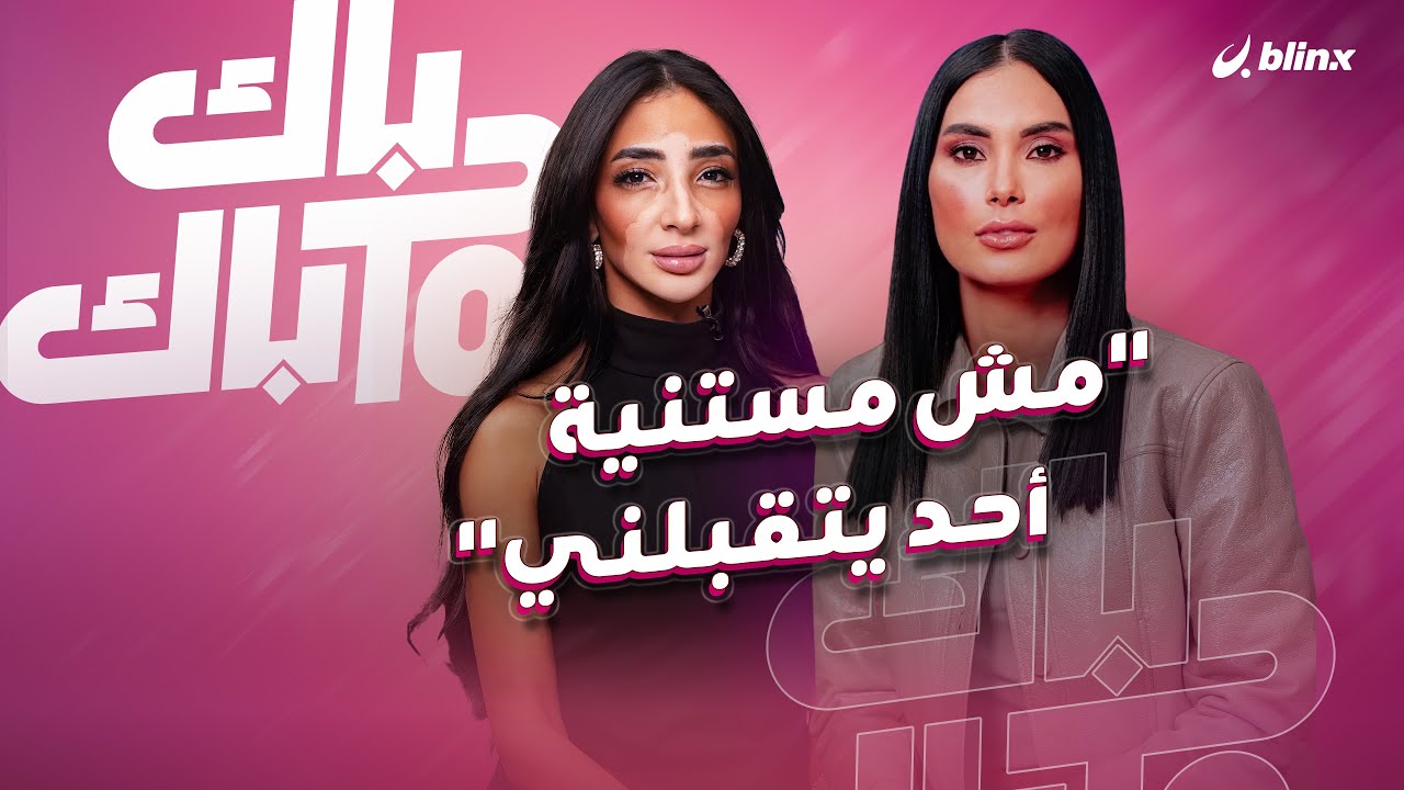 تحدت البهاق واقتربت من لقب ملكة جمال الكون.. لوجينا صلاح: مش مستنية أحد يتقبلني