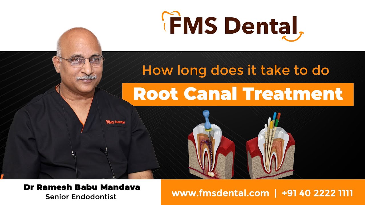 How long does it take to do a Root Canal Treatment | Best Dental Clinic for RCT in Hyderabad | FMS