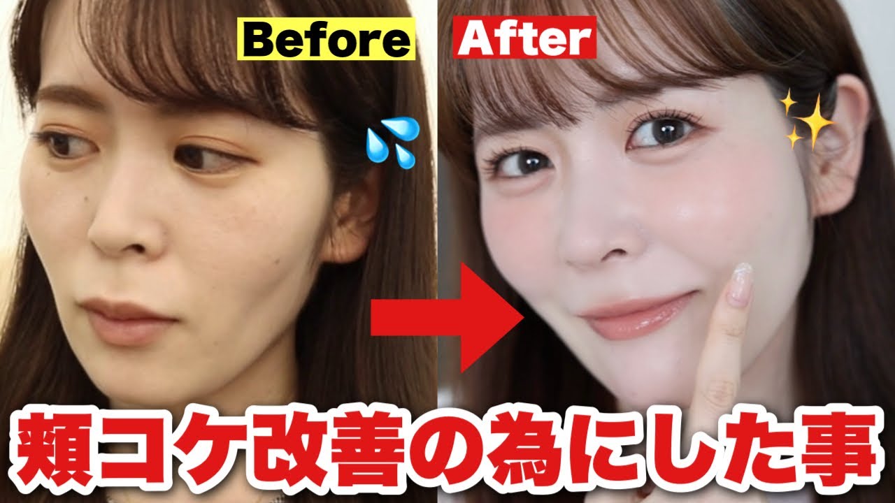 【保存版】頬コケ改善するためにやってよかった事&やめてよかった事を全部大公開します！！！