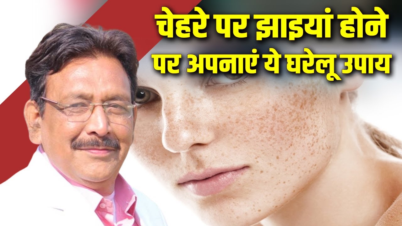 चेहरे पर झाइयां होने पर अपनाएं ये घरेलू उपाय | Hakim Suleman Khan | Sadhna TV