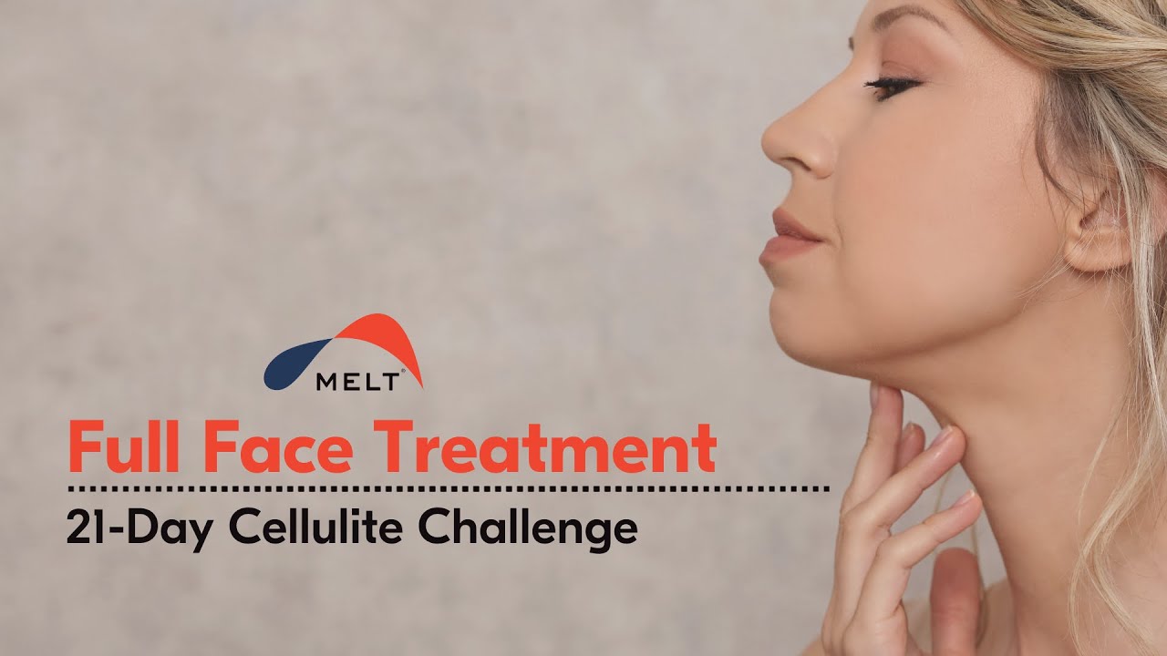 Full Face Treatment  | Day 20 | MELT Method