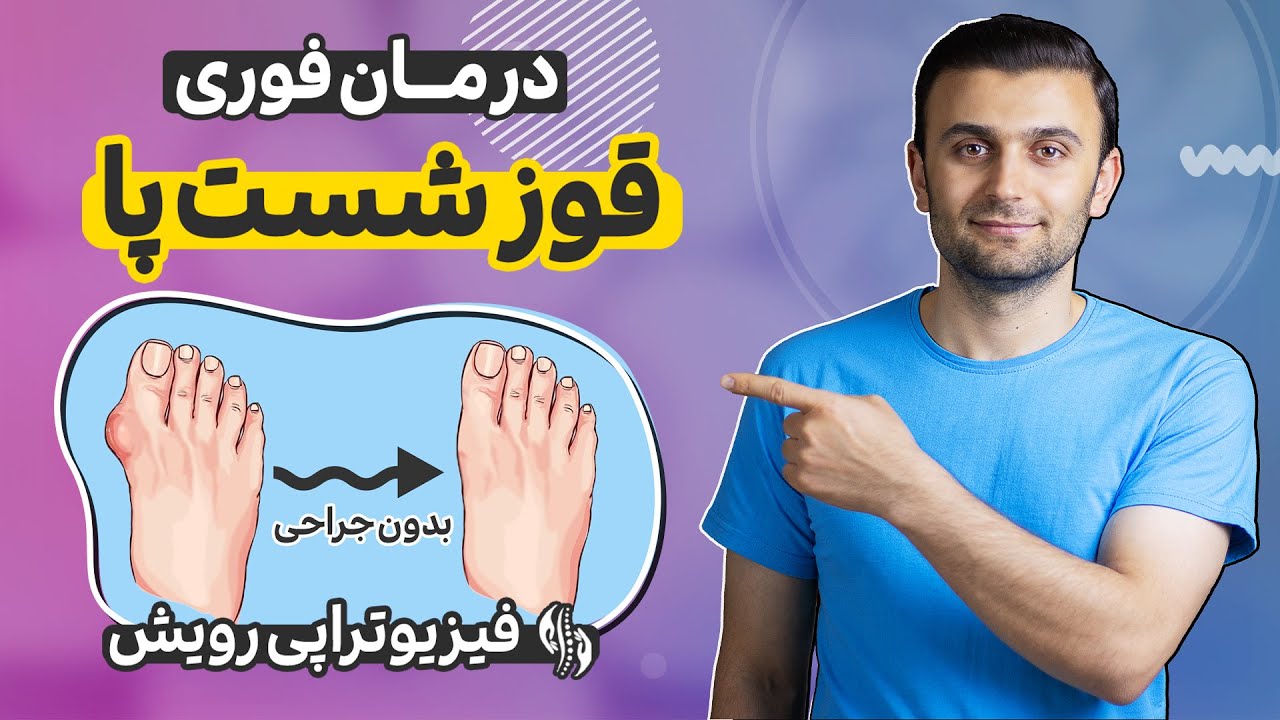 درمان قوز شست پا با 4 حرکت موثر خانگی