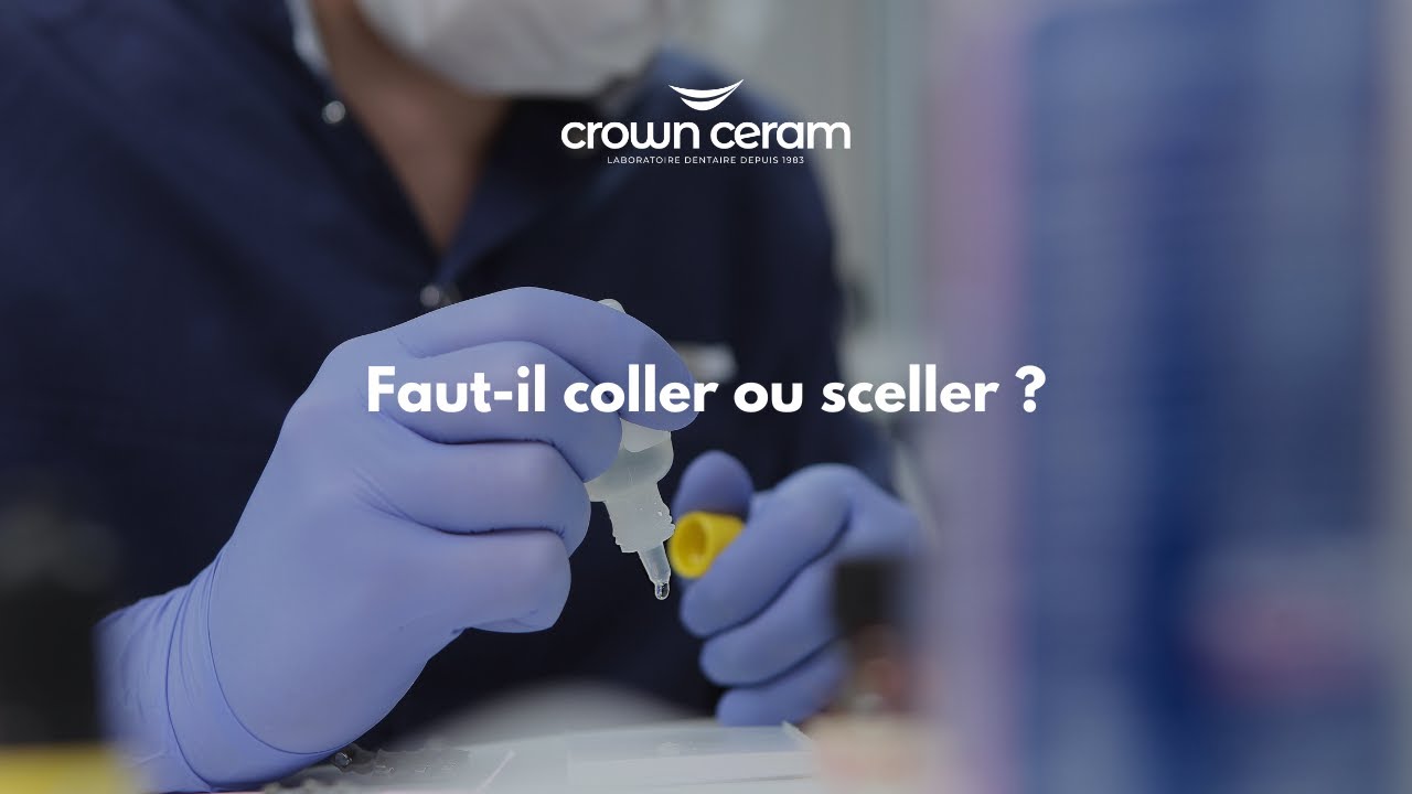Coller ou sceller ?
