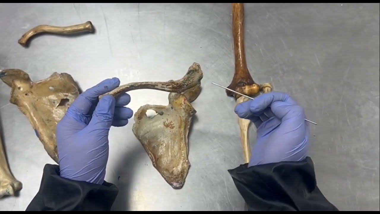 Pr&aacute;ctica de osteolog&iacute;a (Clav&iacute;cula, Escapula, Humero, cubito, radio, carpos)/ Doctor Ro/ Anatom&iacute;a