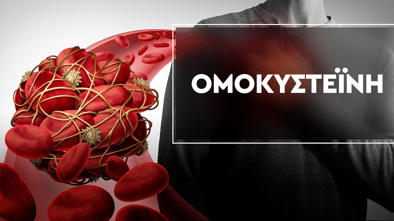 Ομοκυστεΐνη | Ποιους κινδύνους επιφυλάσσει για την καρδιά;