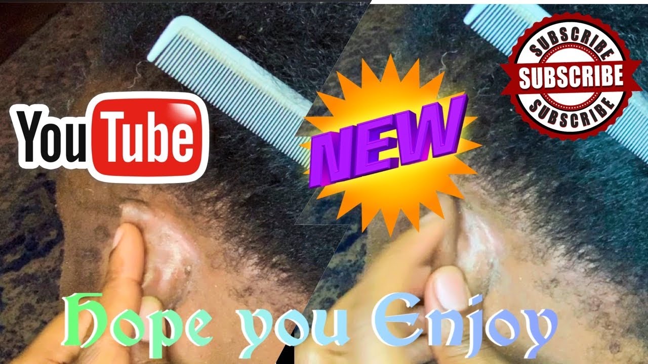 Scratching Auntie Scalp‼️❤️#ASMR