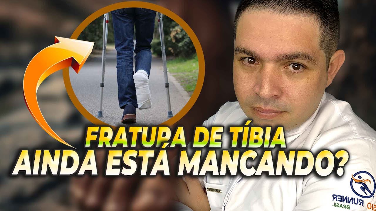VOCÊ AINDA ESTA MANCANDO APÓS CIRURGIA DE TIBIA