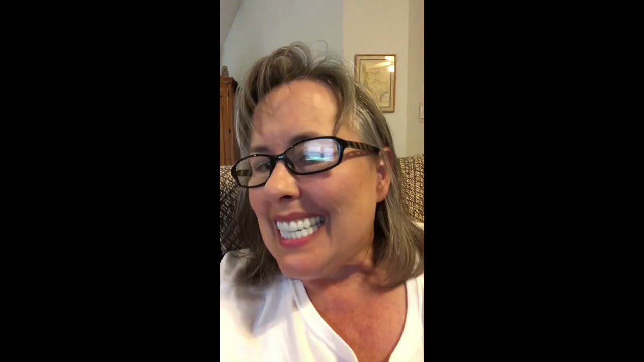 Update on the XircOn Ultimate teeth!