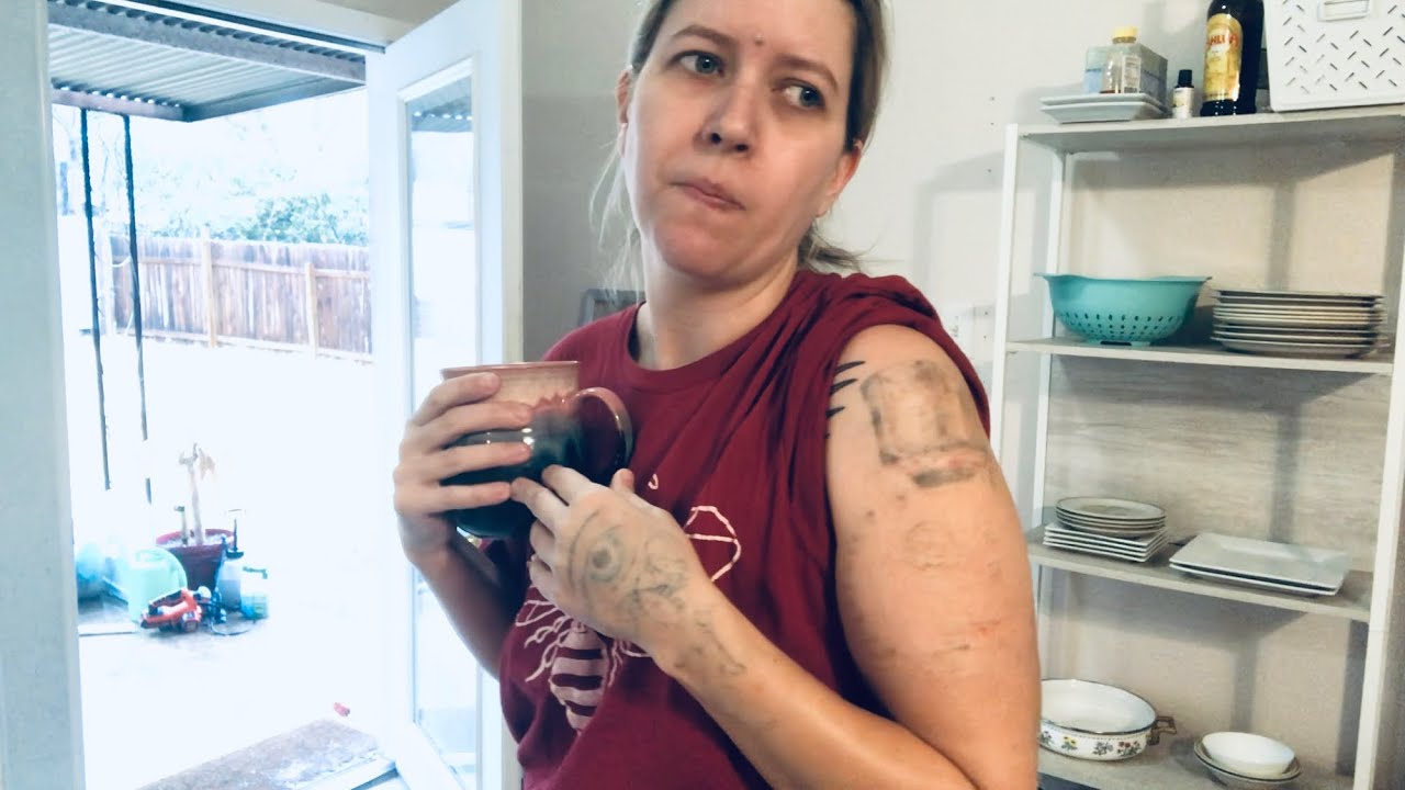 12th session LASER TATTOO REMOVAL on 2 large tattoos at the same time
