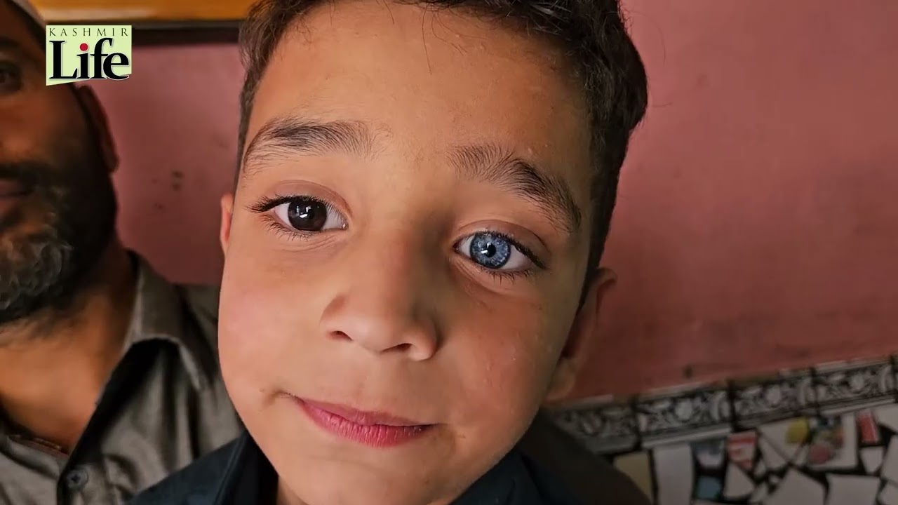 Two Eyes, Two Colours