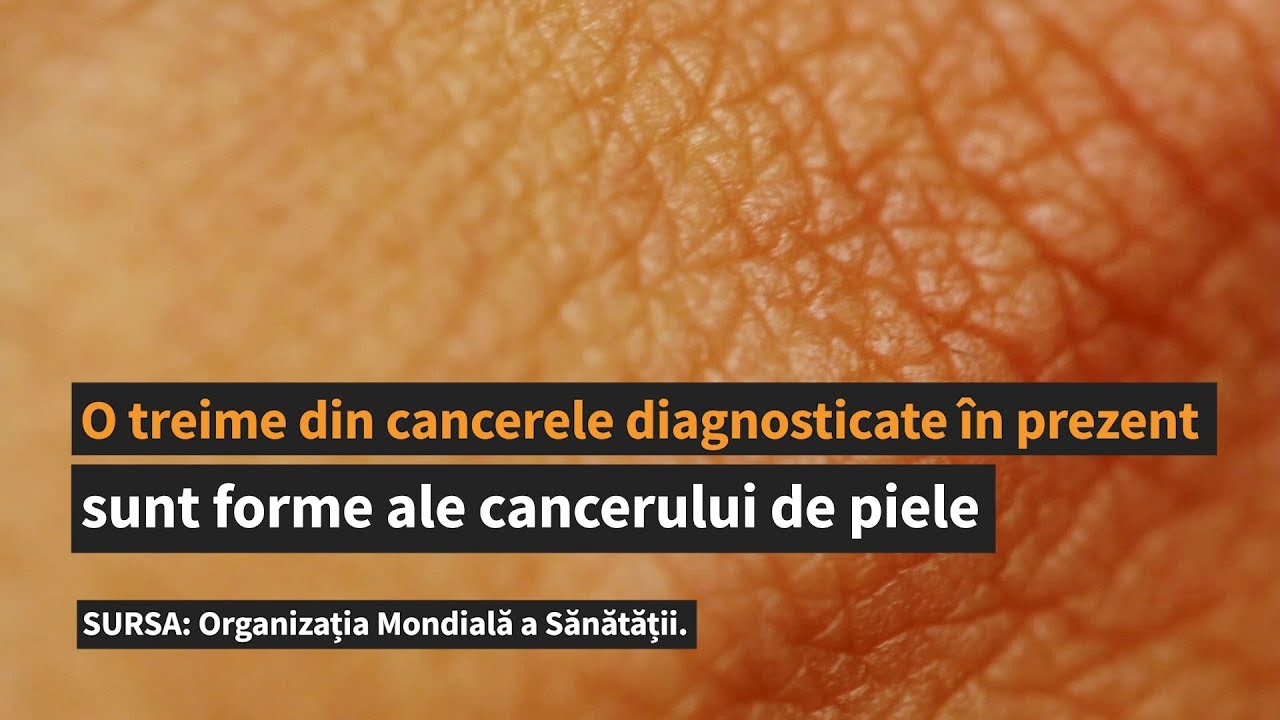Mituri și adevăruri despre alunițele periculoase
