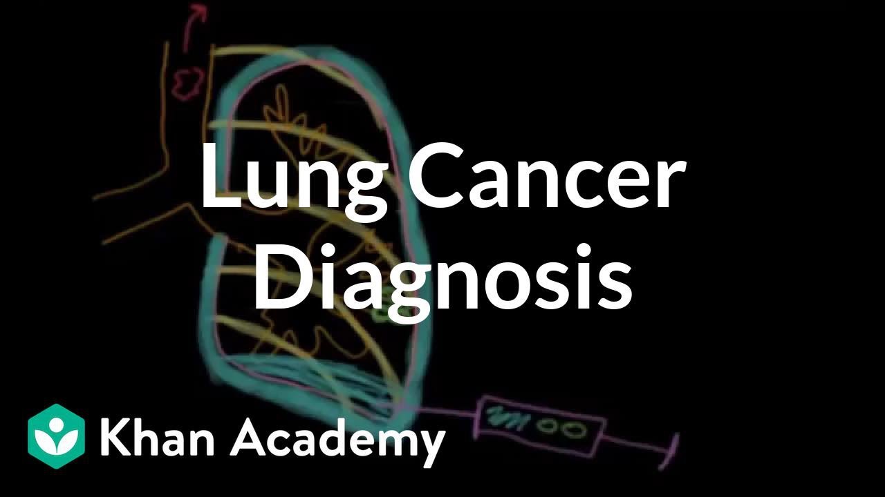 Lung cancer diagnosis | Respiratory system diseases | NCLEX-RN | Khan Academy