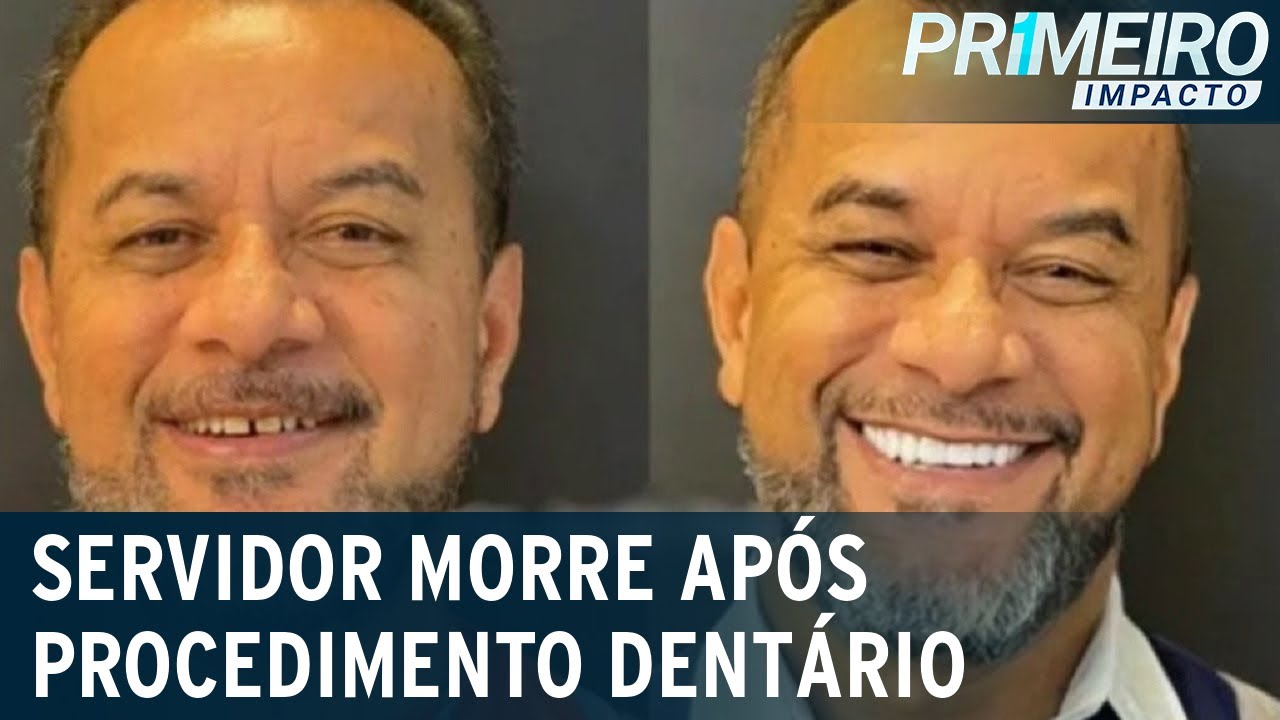 Servidor público morre após aplicação de facetas dentárias | Primeiro Impacto (08/09/22)