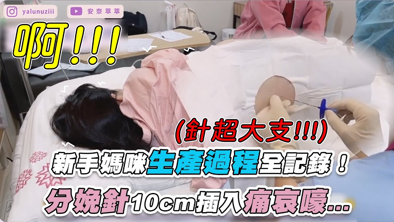 【新手媽咪生產過程全記錄！分娩針10cm插入痛哀嚎...】｜