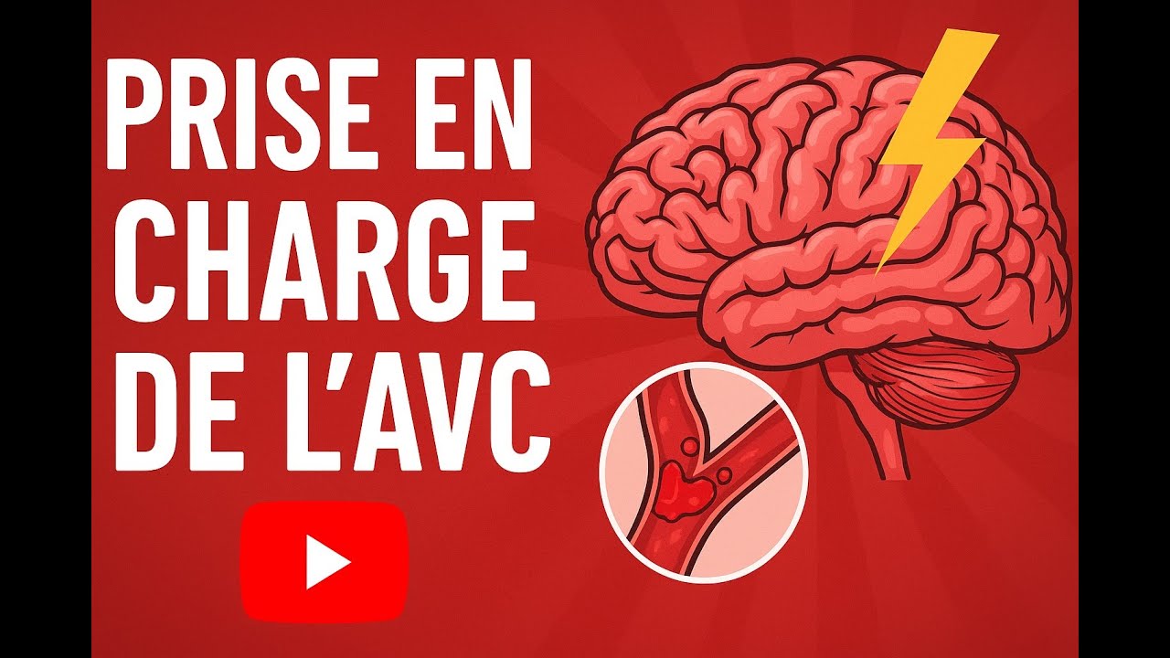 Cours 4 - Accidents Vasculaires Cérébraux : Comprendre l'Urgence et les Signes d'Alerte