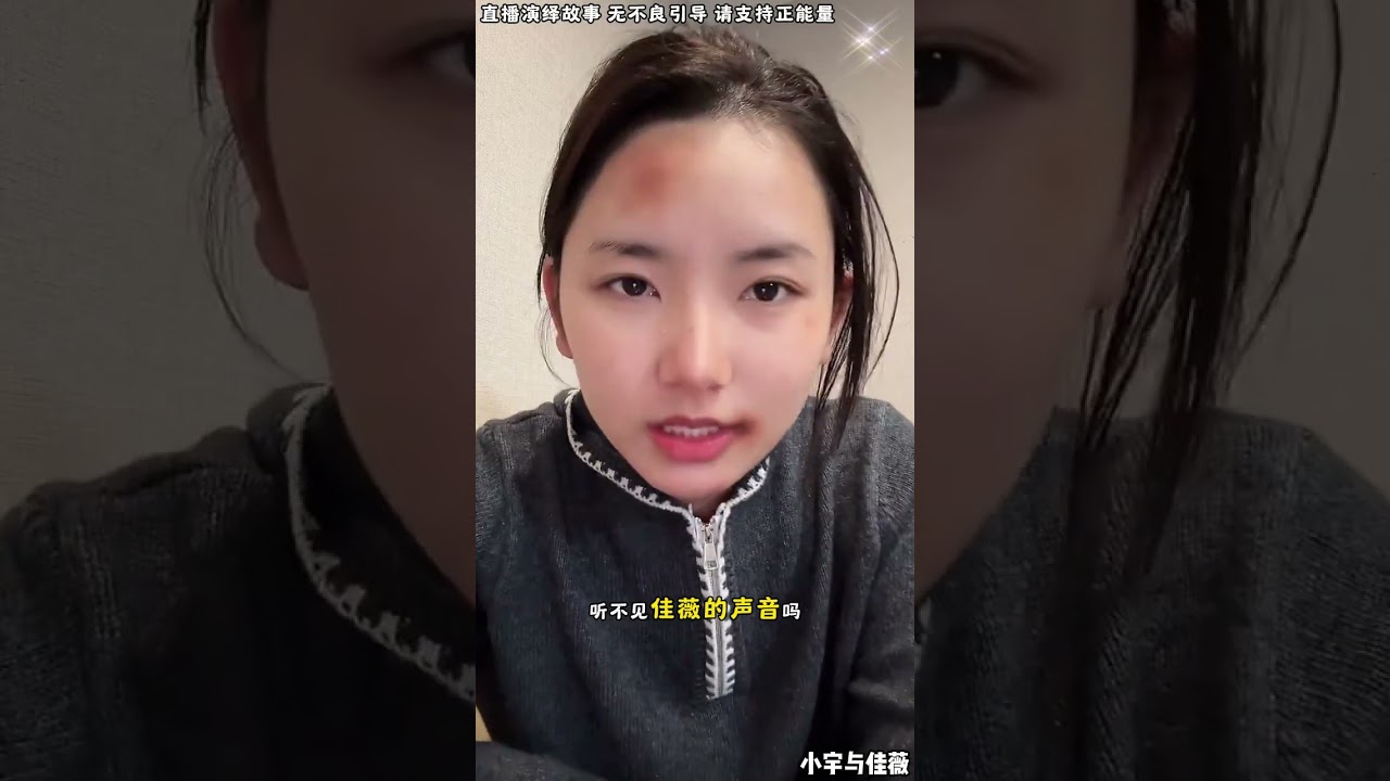 小宇与佳薇：佳薇这几天发生了什么，佳薇头上到处是伤。【松哥】#阿梅#王飞#鹏少#金枝#阿曲莫#阿强#吉连#李子赫#农村姑娘