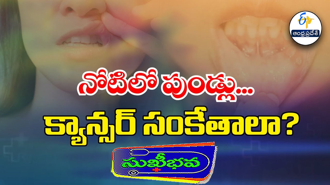 నోటిలో పుండ్లు... క్యాన్సర్ సంకేతాలా?| Mouth Ulcers-are they Cancer sings? | Sukhibhava | 24th Jan26