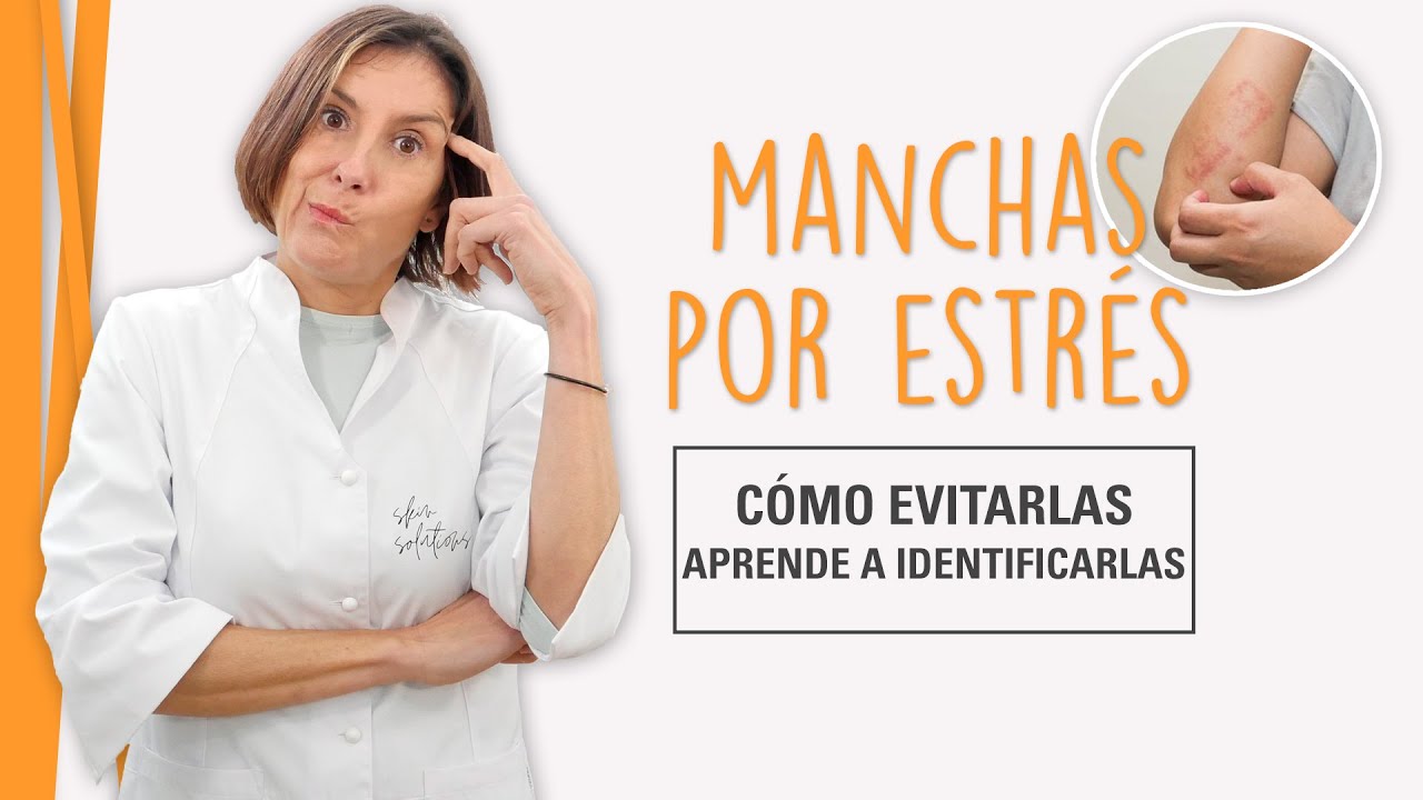 Manchas en la Piel por Estrés - Aprende a Evitarlas