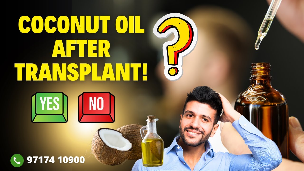 Should You Use Coconut Oil After a Haircut or Hair Transplant? | Dr. Santpal Sangwan Explains