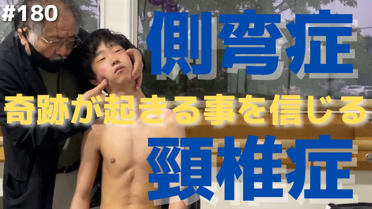 【頸椎症】【側弯症】幼い頃から両手の痺れで生活に支障があり運動が出来ない１５歳の少年の矯正。「奇跡を信じる」DC塩川のカイロプラクティック矯正！