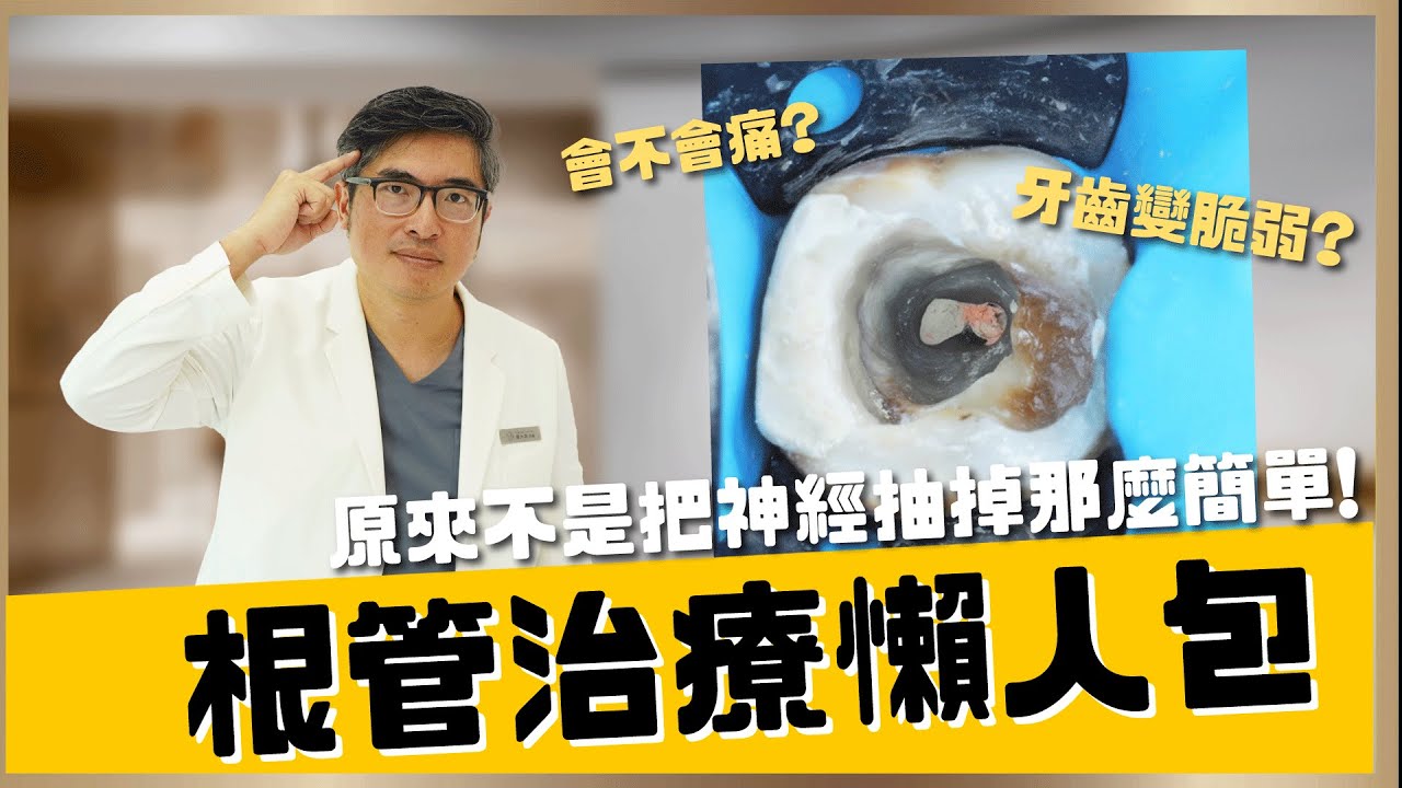 【蛀牙 #6】根管治療是什麼？治療一定要抽神經嗎😱😱顯微根管治療為什麼比較厲害？｜【祐民牙醫－隱適美旗艦店】鑽石級楊大為醫師