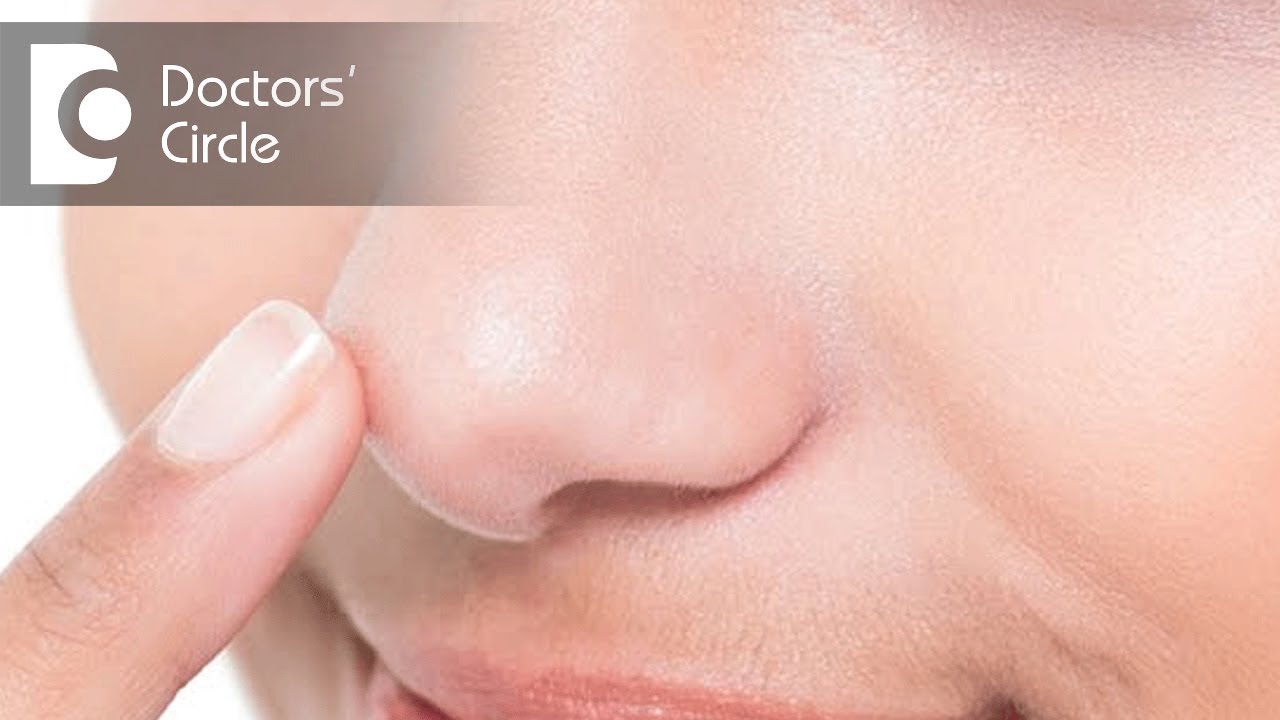 Can infection transfer from little's area in nose? - Dr. Satish Babu K