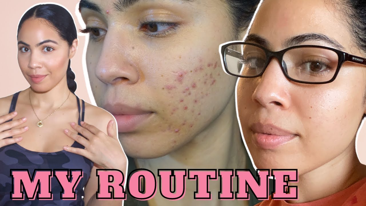 The Routine That Transformed My Skin When Nothing Else Worked