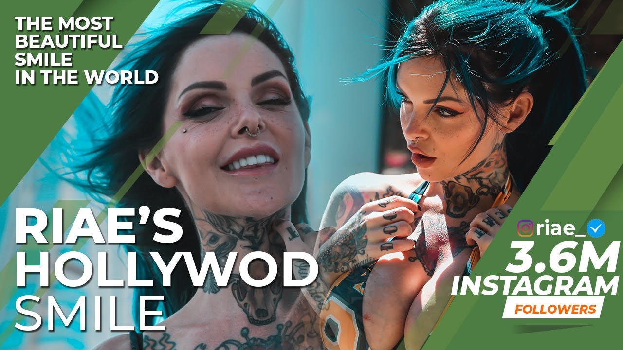 Riae's HOLLYWOOD SMILE in TURKEY