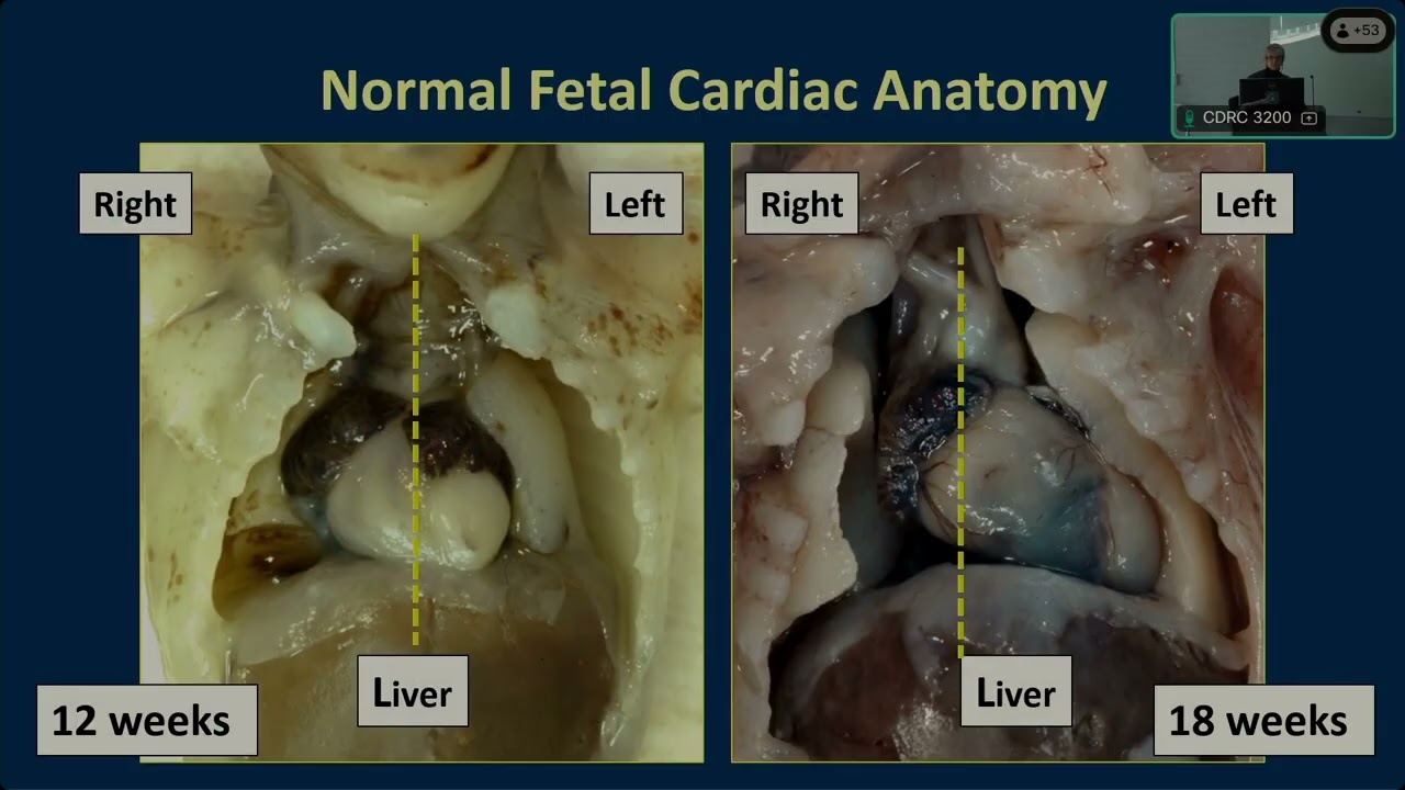 Embryology and Fetal Cardiac Development