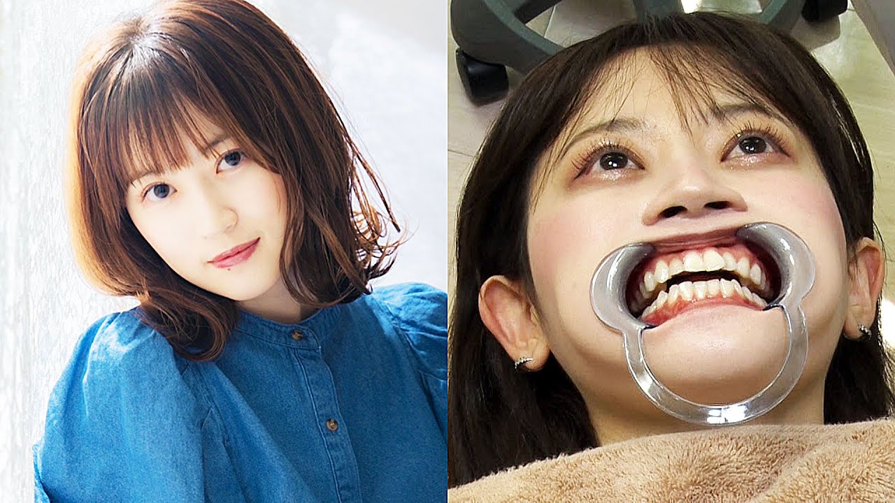 Surprise Bad Breath Check: 22-Year-Old Model Miwa Gets a Deep Clean for Stubborn Stains!