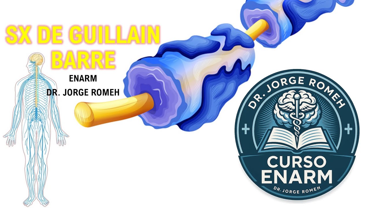 SINDROME DE GUILLAIN BARRE (SGB) - ENARM - TODO LO QUE DEBES SABER