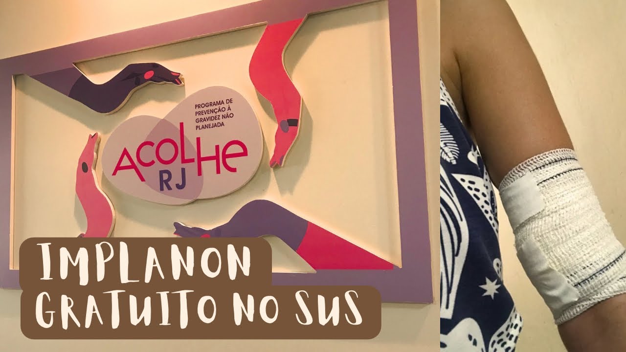Tudo sobre o Implanon feito pelo SUS | Projeto Acolhe RJ