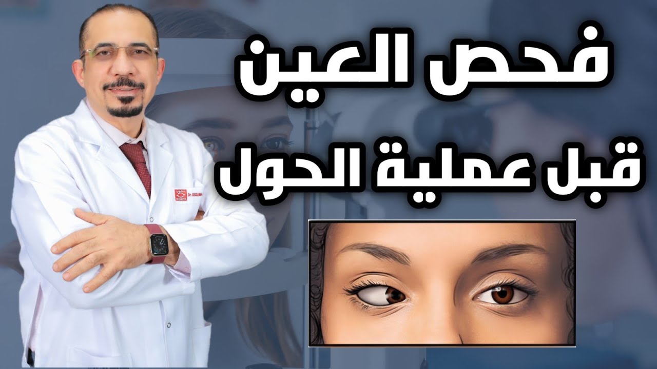 فحص العين قبل عملية الحول أهم خطوة لعلاج الحول 👁