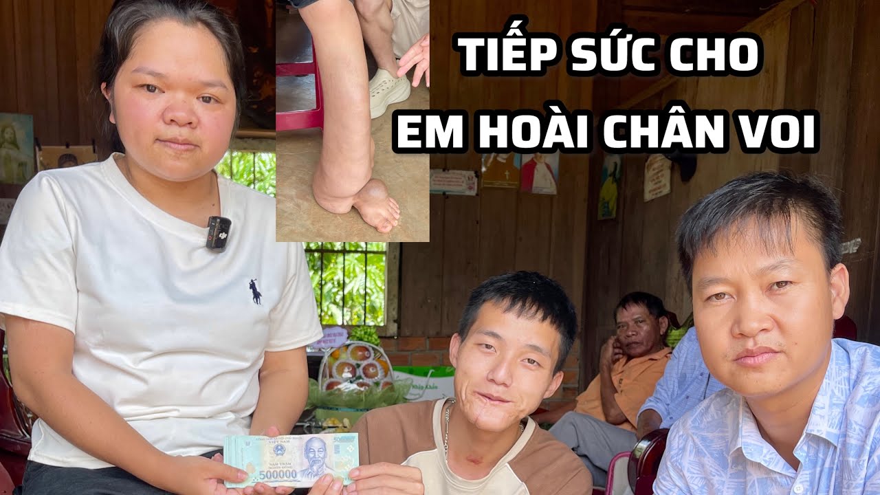 ❤️Thêm một phép màu nữa đang đến với em Hoài chân voi...