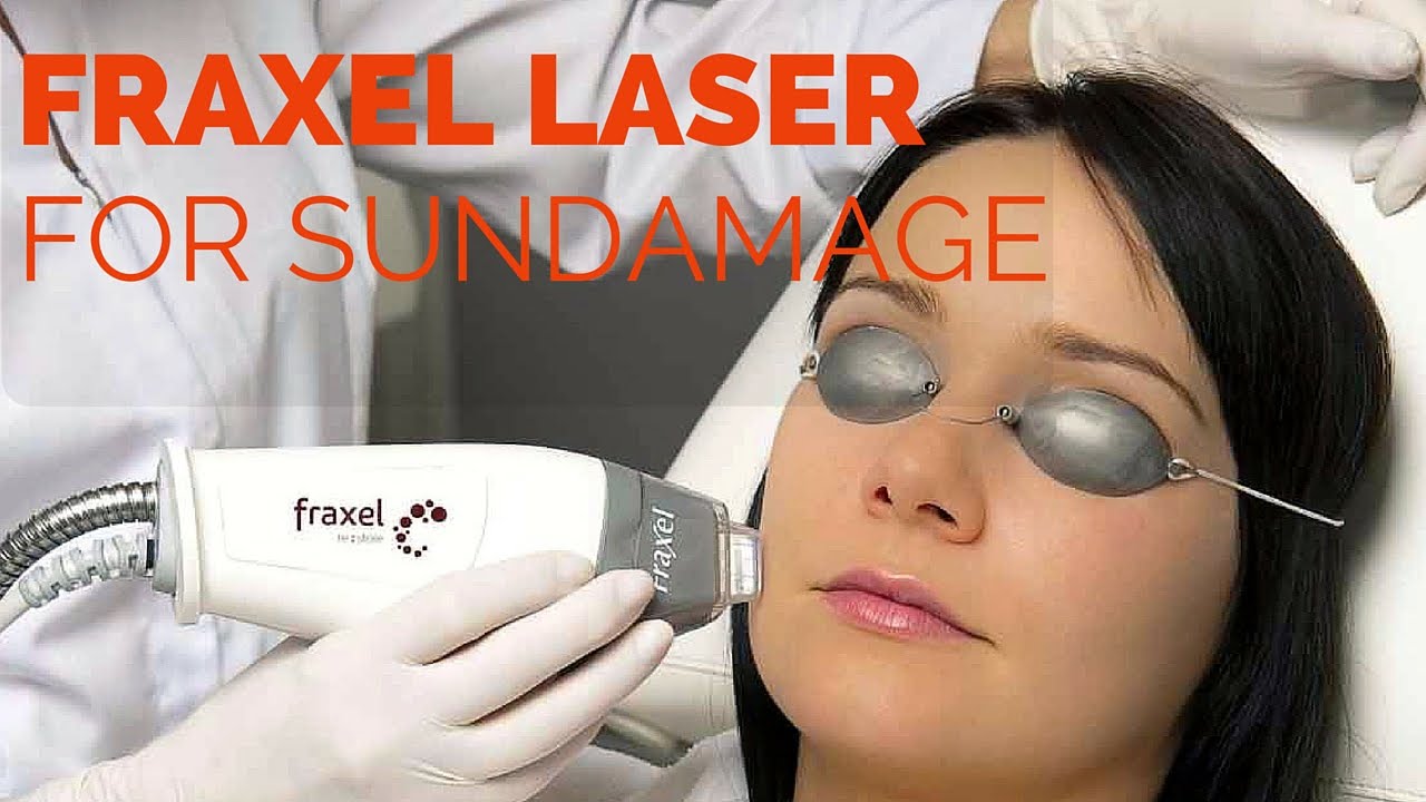 Fraxel Fractional laser resurfacing