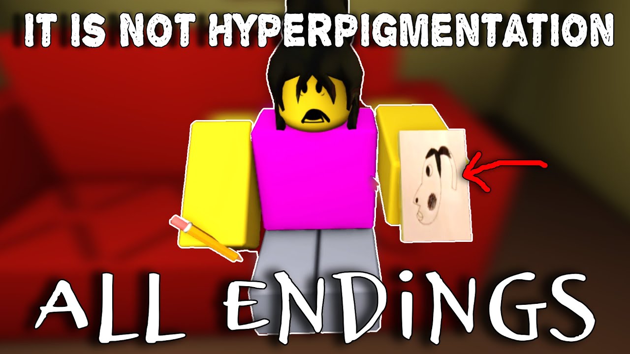 It Is Not Hyperpigmentation - All Badges - All Endings [ROBLOX]
