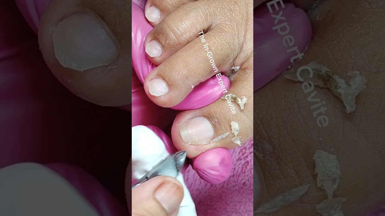 Full video pedicure and dryskin removal