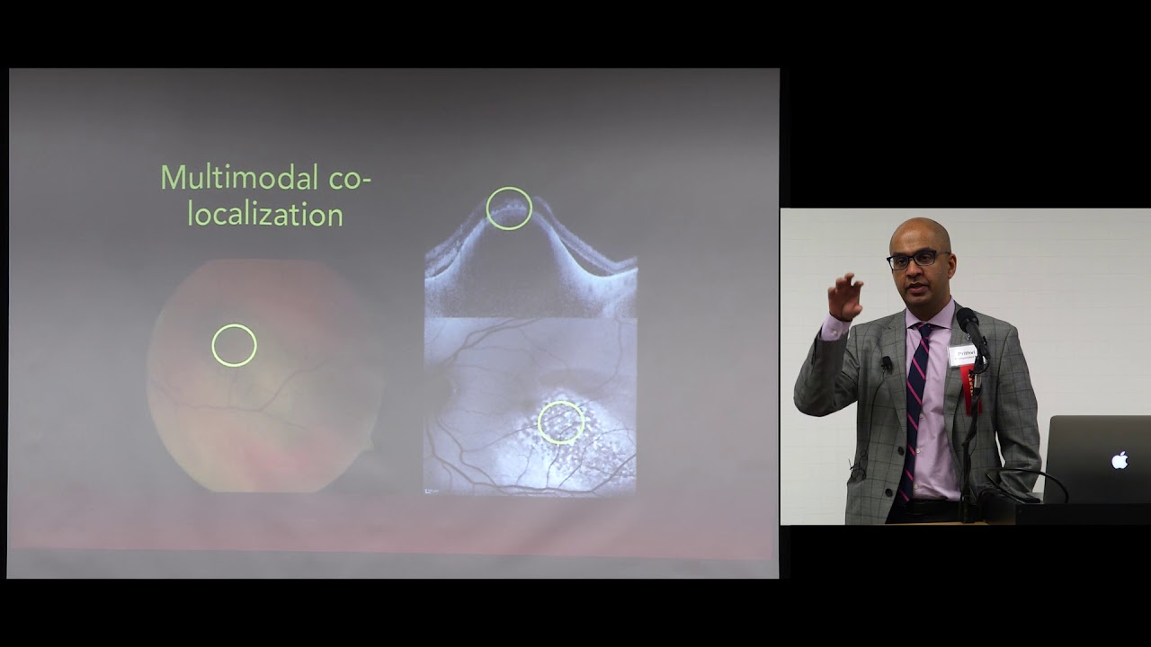Overview of Uveal Melanoma, Dr. Prithvi Mruthyunjaya