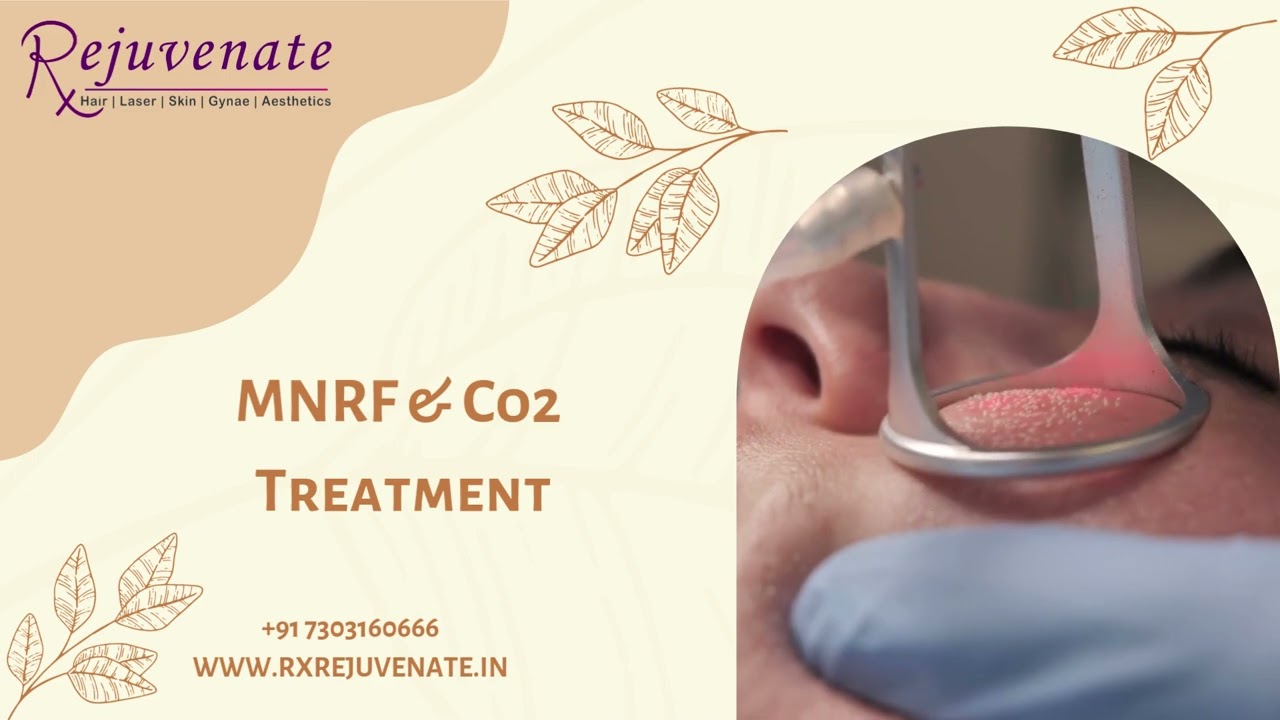 Best Aesthetic clinic in Delhi