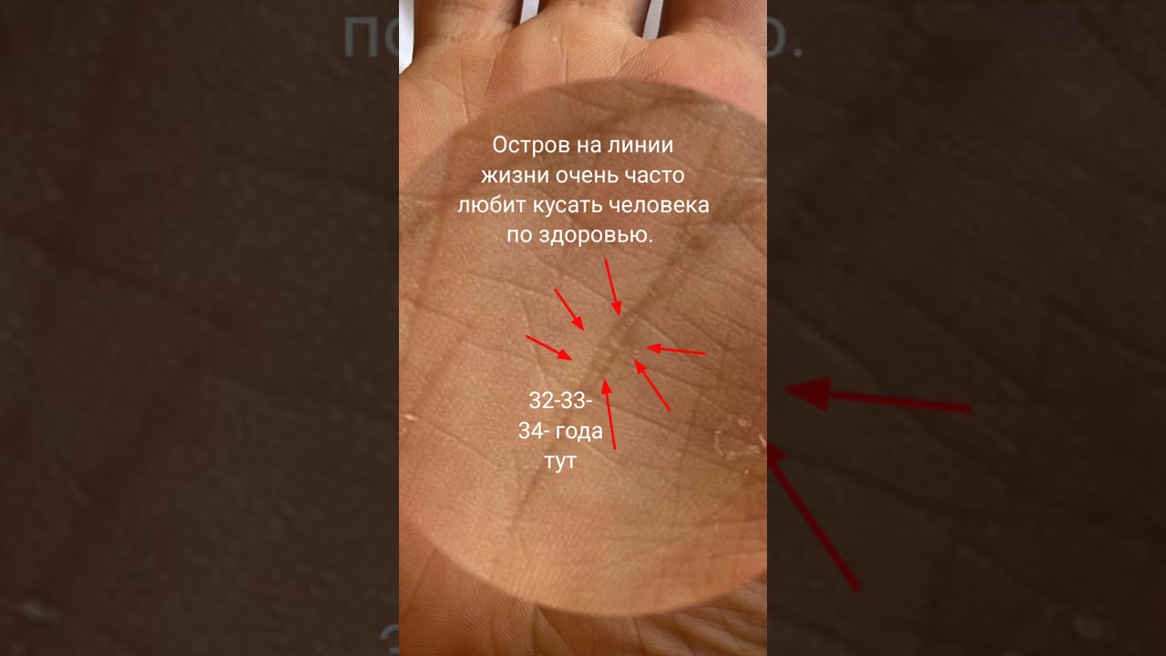Я болею ((( в больнице#хирология