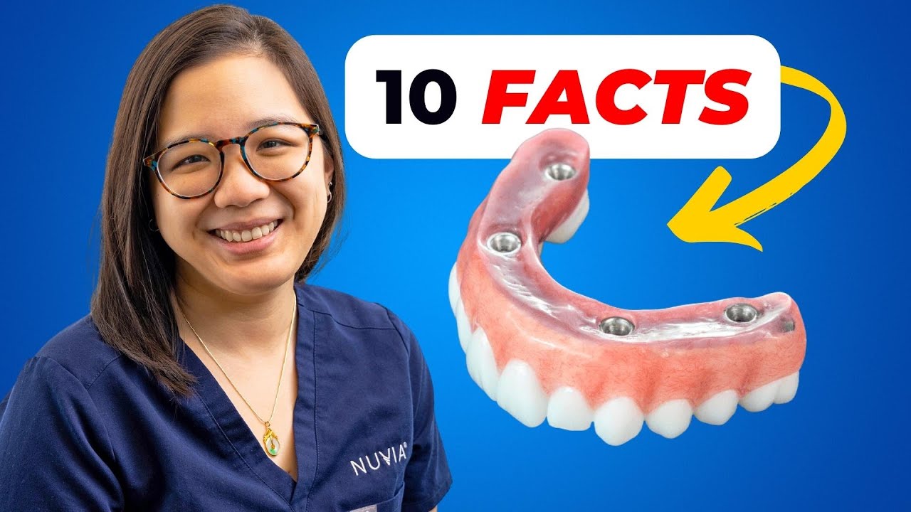10 Facts About All On 4 Dental Implants You Need To Know