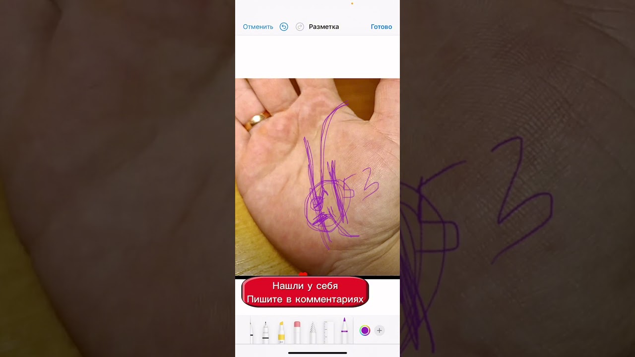 Разрыв на линии жизни