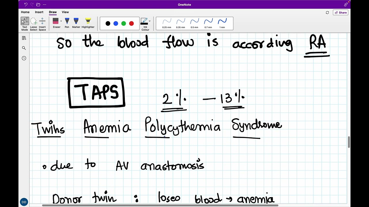 Understanding Twin to Twin Transfusion Syndrome (TTTS) in Simple Terms