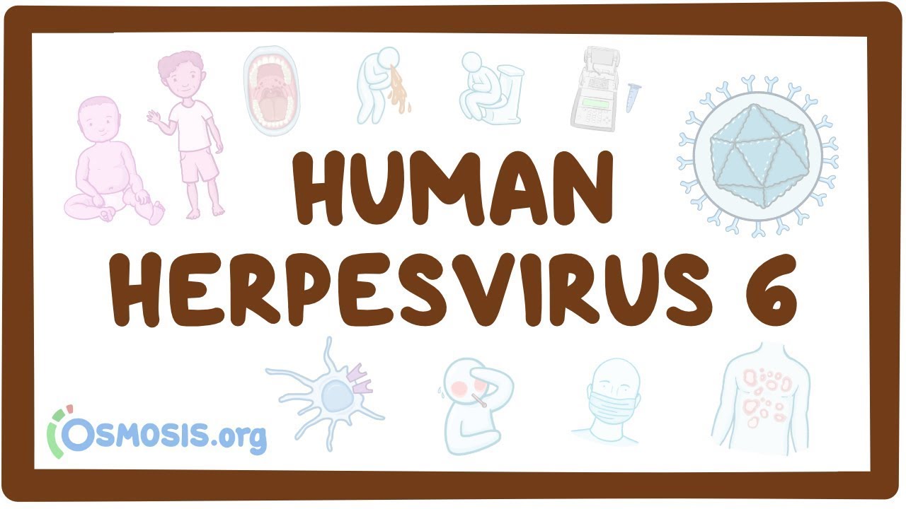 Human herpesvirus 6 (Roseola) - an Osmosis Preview