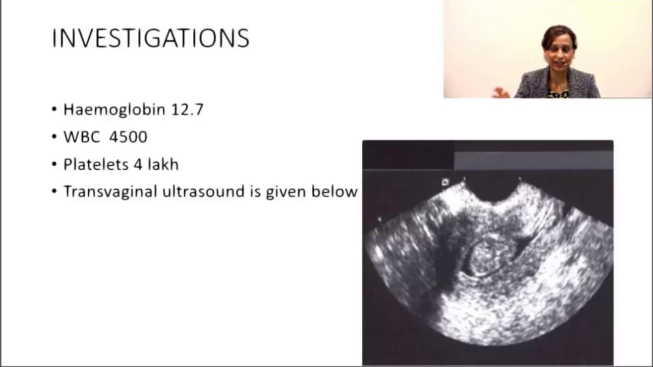 NEETPG Intermenstrual bleeding by Dr Deepti Bahl