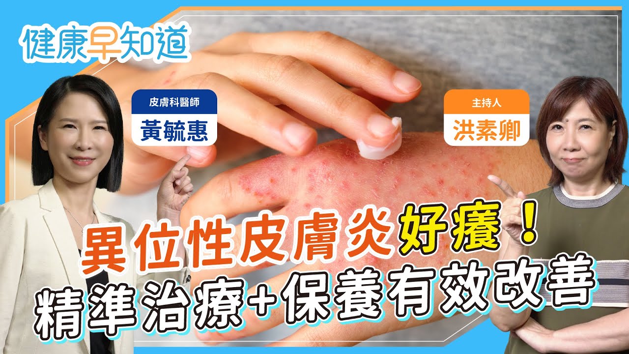 不只類固醇，異位性皮膚炎治療新選擇！日常四招告別反覆發炎，抓過頭後果曝光！有哪些飲食禁忌？生物製劑是什麼？ Feat.黃毓惠醫師｜每週三、五首播｜主持人洪素卿｜【健康素速聊】