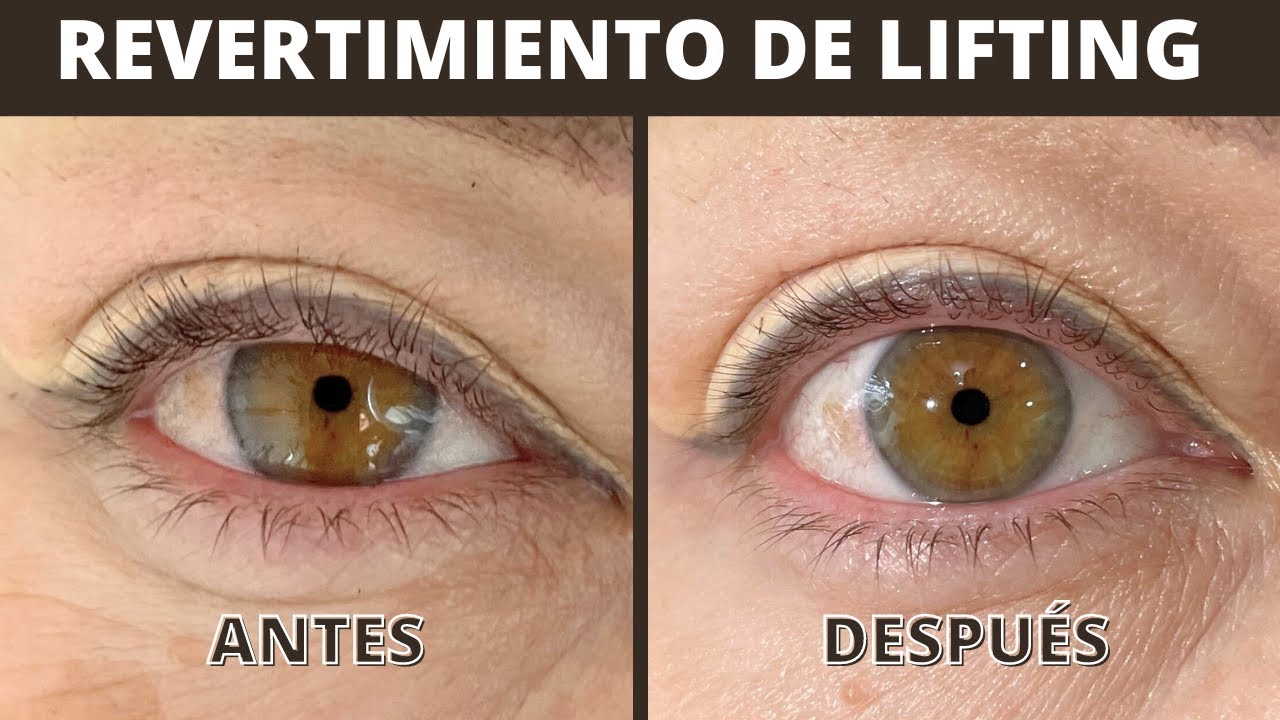 Como quitar el lifting de pestañas paso a paso