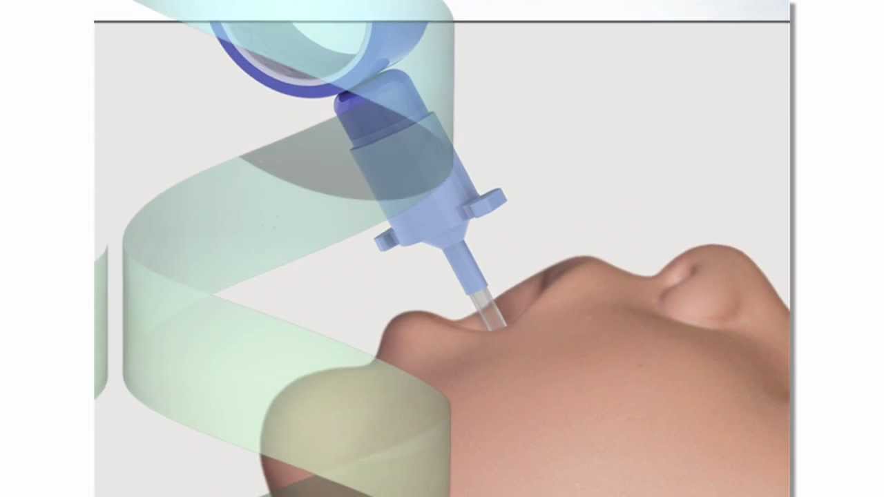 Neonatal Endotracheal Intubation