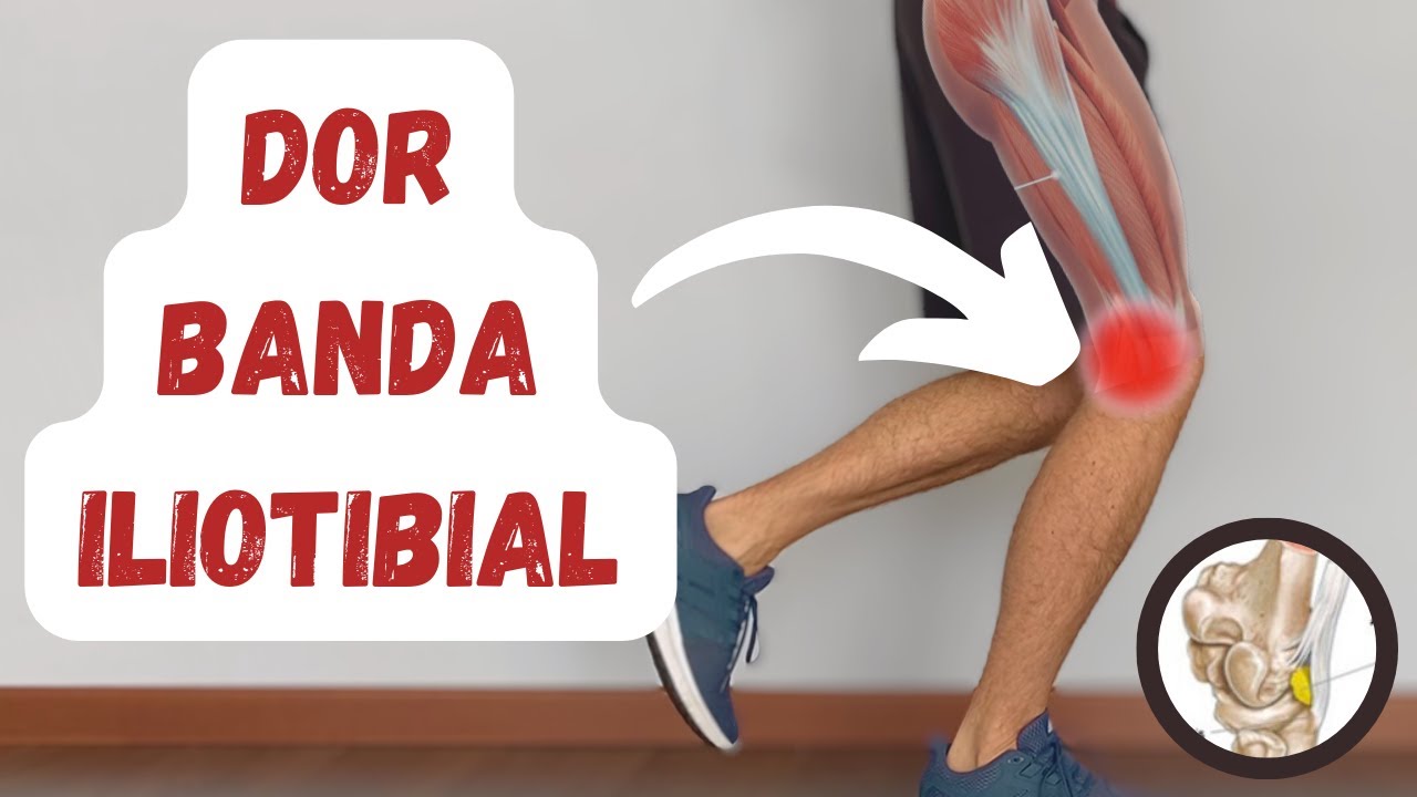 Dor Banda Iliotibial | Síndrome de Fricção da Banda IT (Mitos, Fisioterapia, Exercícios)
